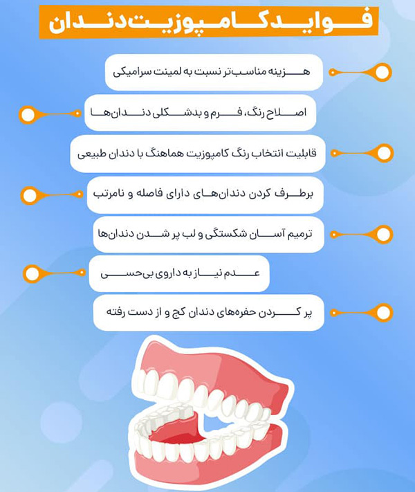 فواید کامپوزیت دندان